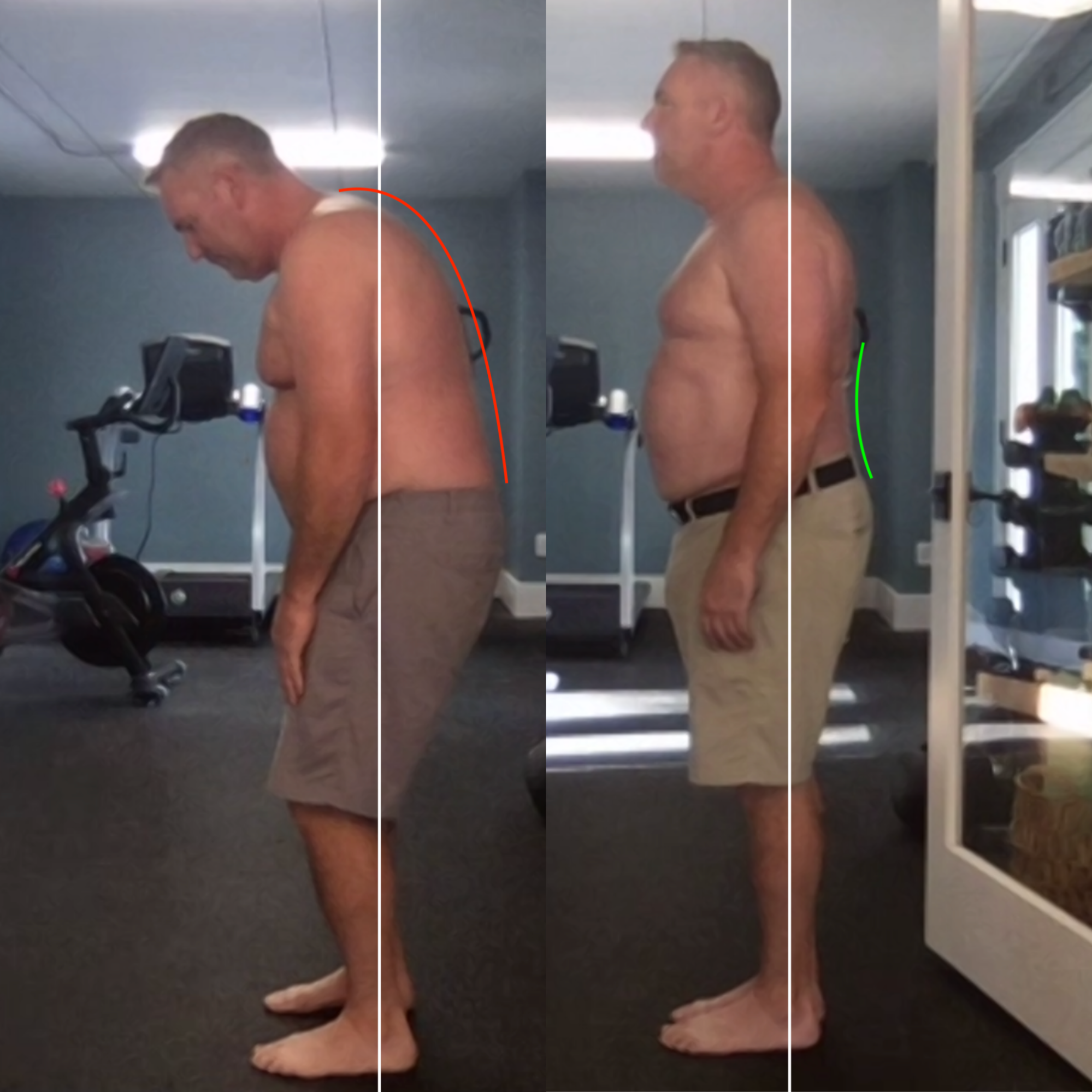 Chris, before and after recovering from a catastrophic low-back flare